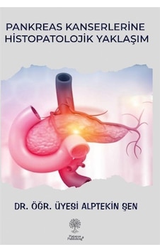 Pankreas Kanserlerine Histopatolojik Yaklaşım - Alptekin Şen - Platanus Publishing Pankreas Kanserlerine Histopatolojik Yaklaşım - Alptekin Şen - Platanus Publishing