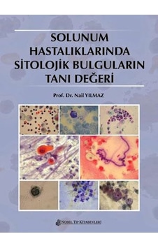 Solunum Hastalıklarında Sitolojik Bulguların Tanı Değeri- Nobel Tıp Kitabevleri Solunum Hastalıklarında Sitolojik Bulguların Tanı Değeri- Nobel Tıp Kitabevleri