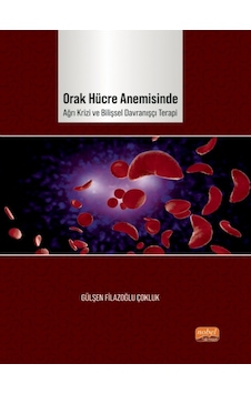 Orak Hücre Anemisinde Ağrı Krizi ve Bilişsel Davranışçı Terapi - Gülşen Filazoğlu Çokluk - Nobel Bilimsel Eserler Orak Hücre Anemisinde Ağrı Krizi ve Bilişsel Davranışçı Terapi - Gülşen Filazoğlu Çokluk - Nobel Bilimsel Eserler