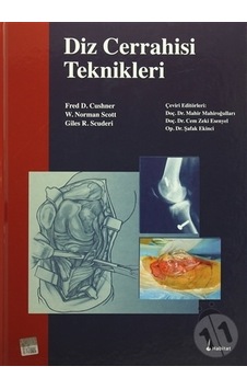 Diz Cerrahisi Teknikleri