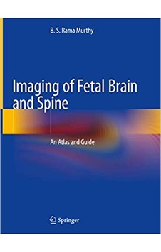 Imagıng of fetal Brain and Spine