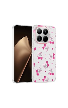 Xiaomi 15t Pro Kılıf Kamera Korumalı Desenli Zore Klip Kapak Xiaomi 15t Pro Zore - Kalpli Kiraz Xiaomi 15t Pro Kılıf Kamera Korumalı Desenli Zore Klip Kapak Xiaomi 15t Pro Zore - Kalpli Kiraz