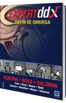 Expert Ddx: Beyin Ve Omurga/Anne G. Osborn.Jeff Ross.Karen L. Expert Ddx: Beyin Ve Omurga/Anne G. Osborn.Jeff Ross.Karen L.