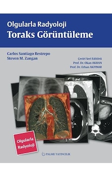 Olgularla Radyoloji Toraks Görüntüleme (Palme)