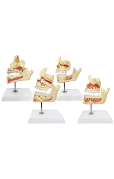 Diş Gelişimi Modeli, 4 Aşamalı, Gerçek Boyutlu, 4 Parçalı, Kaide Ve Stand Üzerinde - Diş Maketi 01 Diş Gelişimi Modeli, 4 Aşamalı, Gerçek Boyutlu, 4 Parçalı, Kaide Ve Stand Üzerinde - Diş Maketi 01