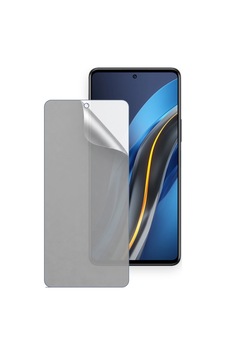 Infinix Note 12 Vıp Uyumlu Ön Yüzey Mat Hidrojel Ekran Koruyucu Infinix Note 12 Vıp Uyumlu Ön Yüzey Mat Hidrojel Ekran Koruyucu