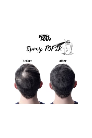 Root Touch Up Sprey / Saç Dolgunlaştırıcı Ve Seyrek Kapatıcı Sprey Topik/ Suda Yağmurda Akmaz 100 Ml