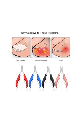 Reedark Stainless Steel Ingrown Toenail Clipper - Thick Nails, Rose Gold, Practical Nail Care Tool