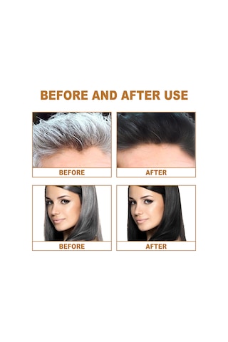 Vkemall Polygonum Multiflorum Saç Sabunu: Melanosit Üretimini Destekler, Saç Yapısını Onarır Ve Parlak Siyah Saçlar Sağlar Kuru - Yıpranmış