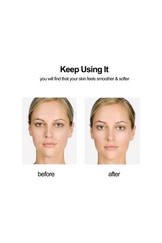 Youtek 13 Adet Silikon Kırışıklık Yama Seti - Alın, Yanak Ve Boyun İçin Anında Düzgünleştirici Cilt Bakımı