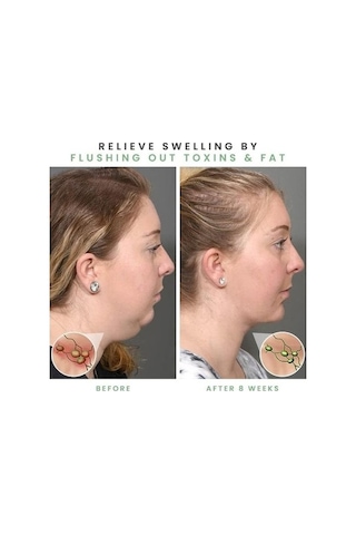 Besthome1 25-80cm Uyumlu Kol Bacak Selülit Önleyici Ayarlanabilir K Altın Masaj Silindiri Kas Rahatlatma Altın