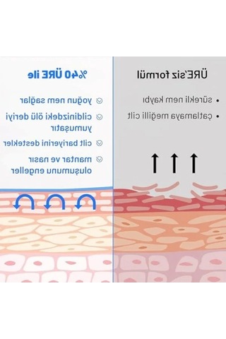 Çatlak Bakım Kremi, 75 Ml, %40 Üre Ve %2 Salisilik Asit