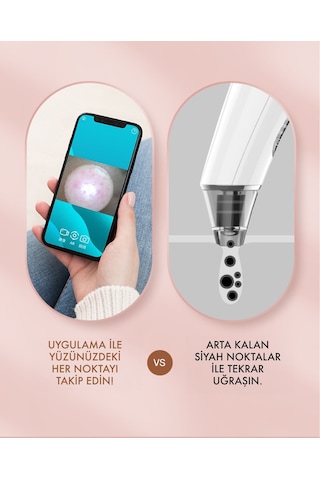 X-Level X-Shinysmart Wi-fi Kameralı Siyah Nokta Temizleme Cihazı