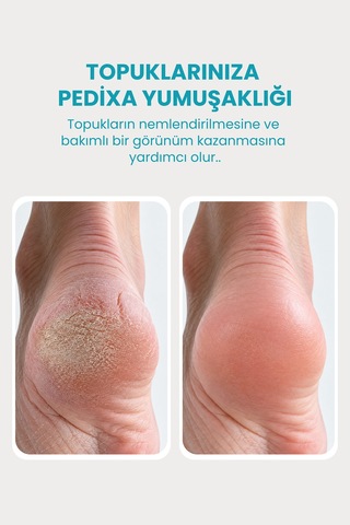 Dermani Pedixa Topuk Bakım Kremi 75 ML