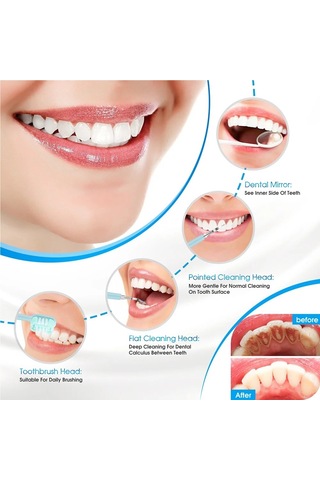 Jialan Elektrikli Diş Taşı Sökücü Diş Temizleme Cihazı Diş