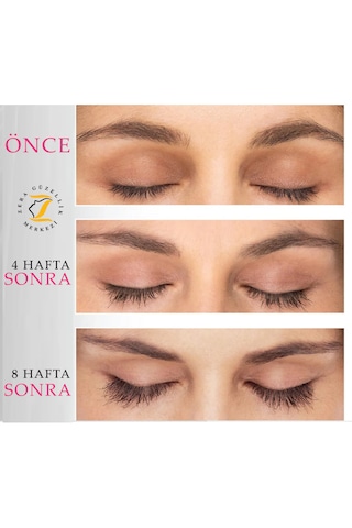 Hairplus X10lash Kirpik Ve Kaş Serumu 01 Açık