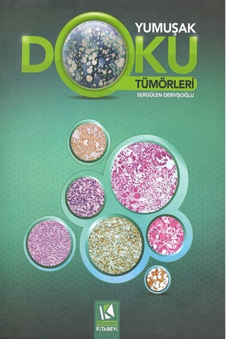 Yumuşak Doku Tümörleri