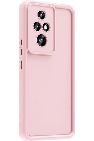 Honor 200 Pro Kılıf Kamera Korumalı Zore Ananas Kapak