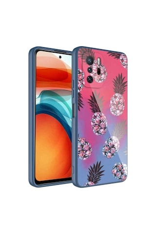 Xiaomi Redmi Note 10 Pro Kılıf Kamera Korumalı Desenli Sert Silikon Zore Epoksi Kapak NO3