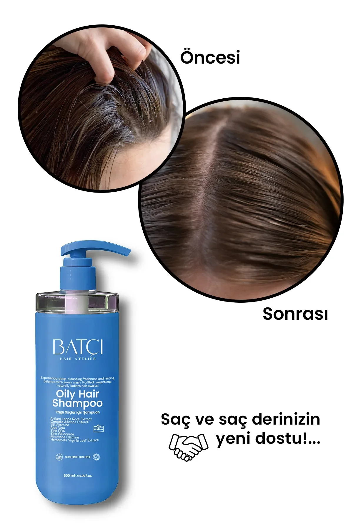 Yağlı Saç Derisi Ve Yağlı Saçlara Özel Yağlanma Karşıtı Saç Bakım Şampuan 500 Ml Tüm Saçlar