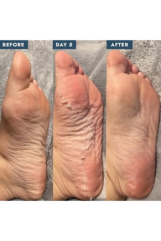 Peeling Bakım Çorabı 40 Ml