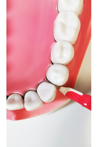 Pearldent Iso 0 Micro - 0.35 MM Kapaklı Arayüz Fırçası 6'lı