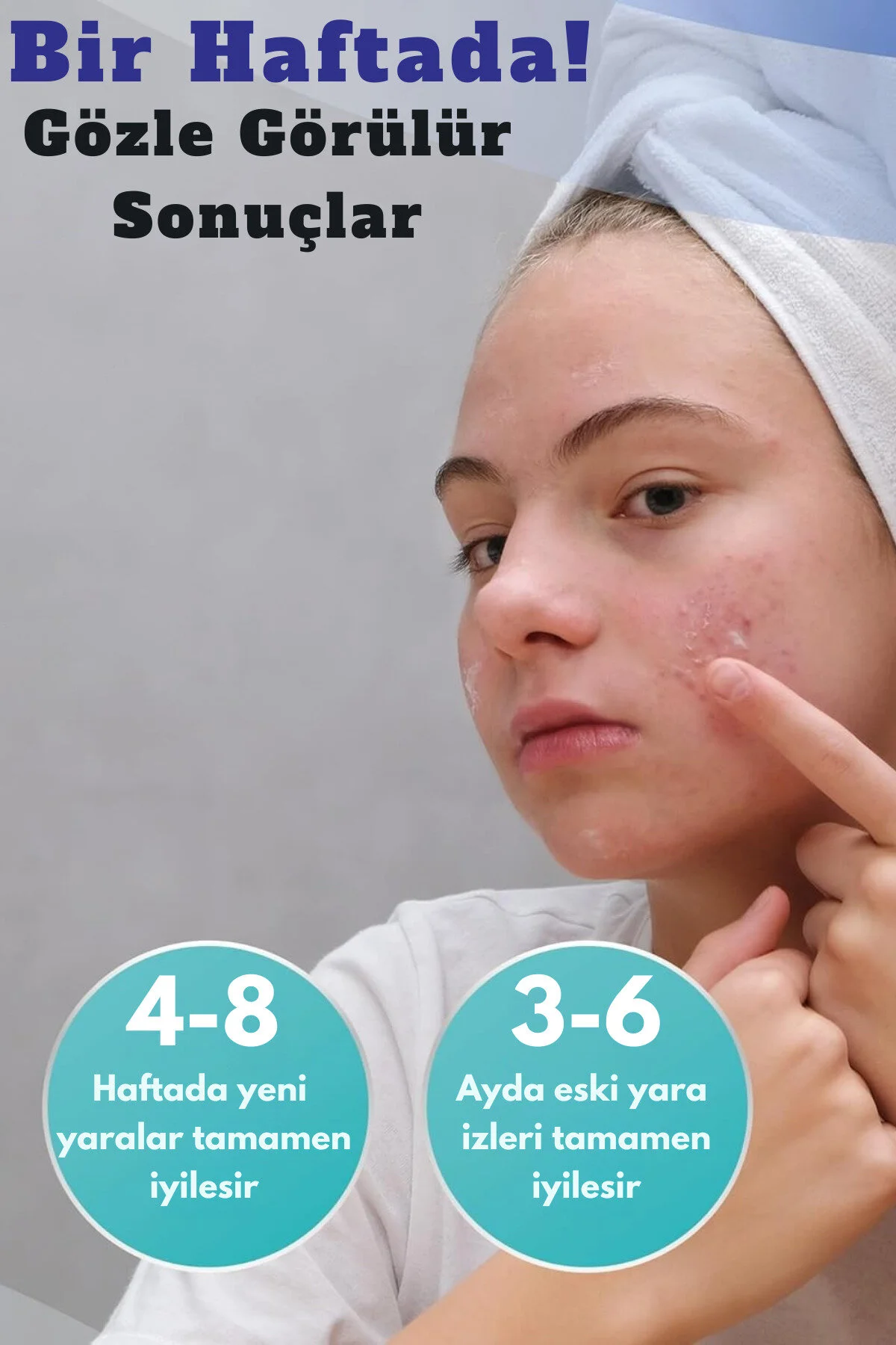 Aroamas Silikon Yara Jeli 30 ML