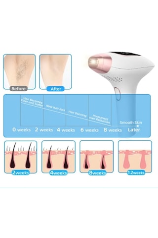 Ultra Hızlı Buz Başlık Profesyonel Lazer 999.999 Atım