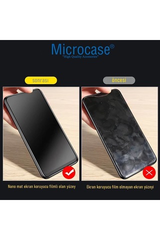Microcase Google Pixel 10 Pro İle Uyumlu Tpu Nano Mat Ekran Koruma Filmi Ekm107