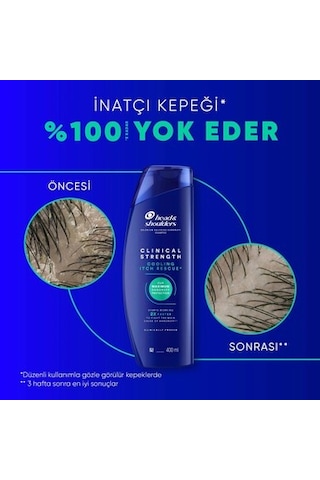 Head&shoulders Head & Shoulders Clinical Strength Cooling Itch Rescue Kaşıntı Karşıtı Şampuan 400