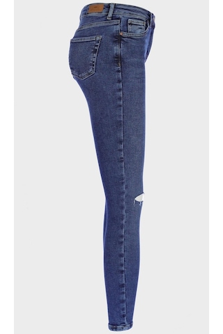 Judy Koyu Mavi Yüksek Bel Dizi Yırtıklı Skinny Jean Pantolon C 4521-195 Koyu Mavi