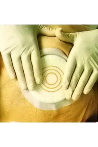 Coloplast 33353 Comfeel Plus Basınç Azaltıcı Yara Örtüsü 10 CM 5 Adet