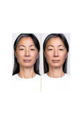 Shiseido Vital Perfection Night Concentrate - Gece Serumu 40 Ml