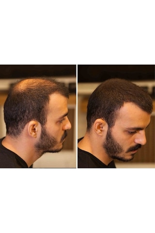 2 Adet Fıxplant 28 Gr Orta Kahve Saç Tozu - Kargo Bedava