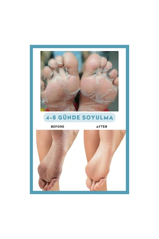 Dermokil Peeling Etkili Soyulabilir Ayak Maskesi 30 ML