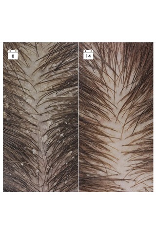 Sephora Collectıon Kepek Karşıtı Nüks Önleyici Serum - Saç Serumu