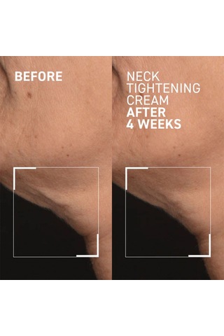 Dr.brandt Needles No More Neck Tightening Cream Sıkılaştırıcı Boyun Kremi