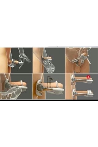 Hızlı Express Size Extender Pro Ultimate Geliştirilmiş Penis Kiti V