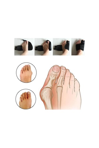 Ankaflex Halluks Valgus Gece Ateli Hallux Başparmak Düzeltici Atel