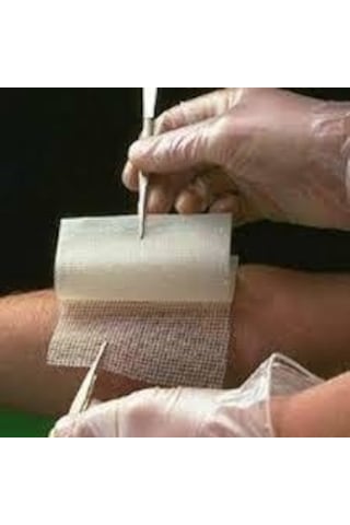 Medikaltec Bactigras 15x20 Adet Fiyatıdır