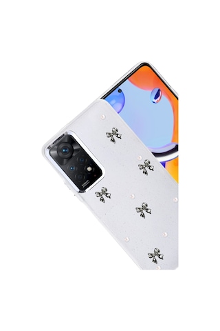 Newface - 545 - Xiaomi Redmi Note 11 Pro Fiyonk Desenli Kapak - - Spt-gld - Desen 8 Diğer
