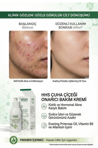 Hhs uha Çiçeği Yağlı Krem Parabensiz 100 ML