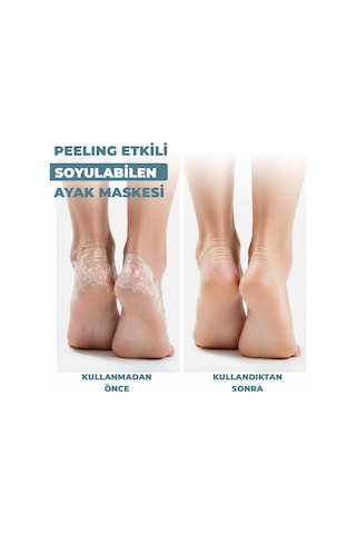 Dermokil Peeling Etkili Çorap Tipi Soyulabilir Ayak Maskesi 30 Ml X 3 Adet