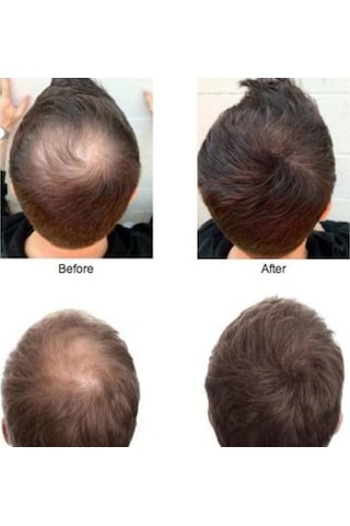 Sevich 25 Gr Siyah Koyu Kahve Saç Fiberi Keratin Saç Tozu