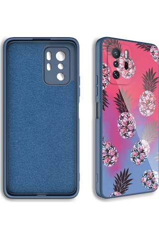 Xiaomi Redmi Note 10 Pro Kılıf Kamera Korumalı Desenli Sert Silikon Zore Epoksi Kapak NO2