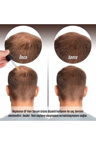Gf Hair Replexion Saç Serumu 4 x 30 ML