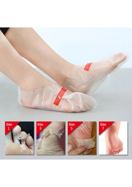 Nasır ve Ölü Deri Temizleyici Ayak Peeling Maskesi