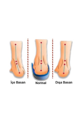 Active Team MG17 - UCBL Ayak Yapısını Düzelten Düz Taban İçin Tabanlık