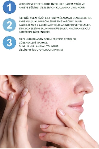 Natexia Anti-Sebium Temizleme Jeli 400 Ml