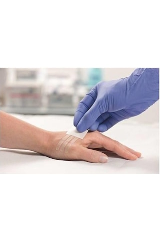 Hartmann Omnistrip Steril Strip Dikiş Bantı 6 x 101MM 10'lu 2 Zarf